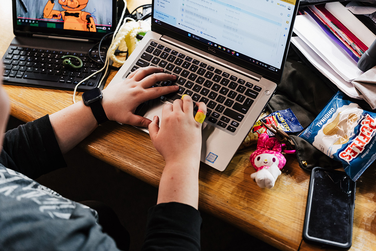 A person typing on a laptop with a yellow band on their finger, surrounded by snacks and a small toy.